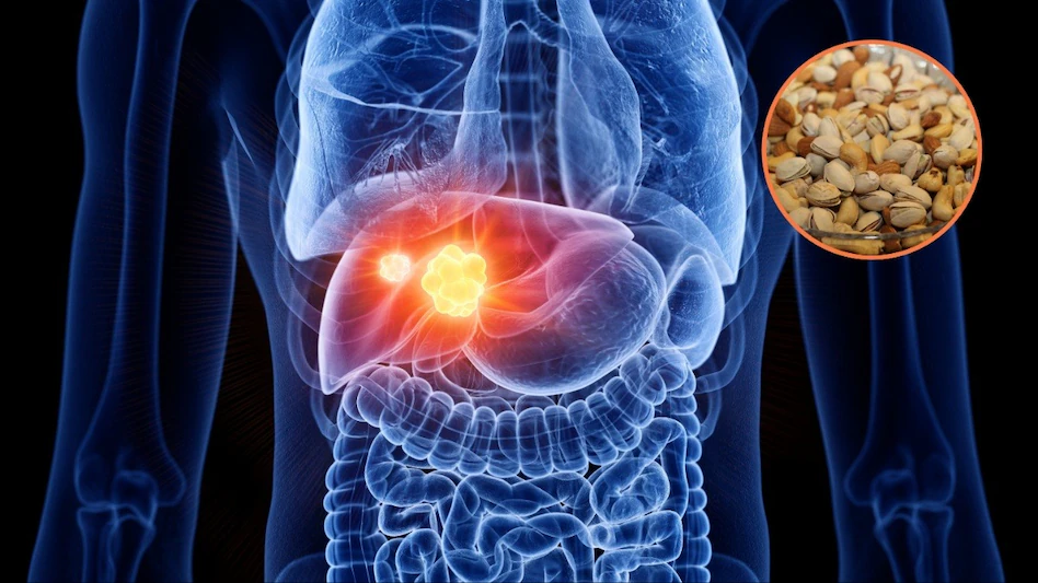 Dry Fruits For Fatty Liver: लिवर के लिए वरदान है ये 4 ड्राई फ्रूट्स, जानें कब और कैसे खाएं 